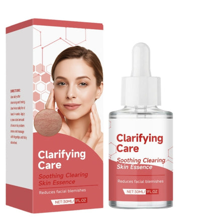 Soothing Acne Treatment Liquid