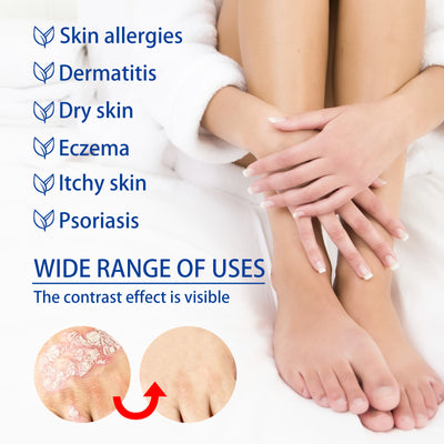 South Moon Skin Care Cream Moisturizes And Moisturizes The Skin Body Apply Skin Care Cream For External Use